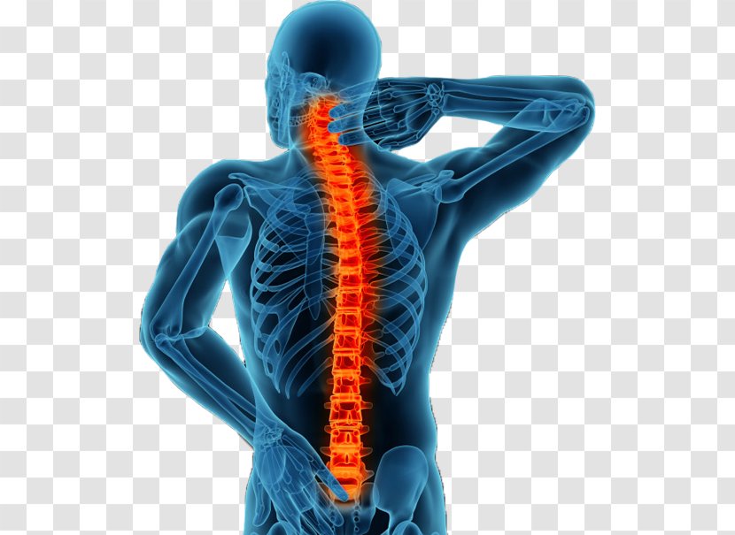 Vertebral Column Minimally Invasive Spine Surgery Spinal Fusion Back Pain - Medical - Human Transparent PNG
