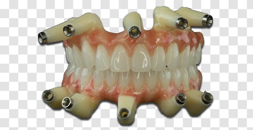 Dental Laboratory Dentures TC Lab Dentistry Jaw - Model Transparent PNG
