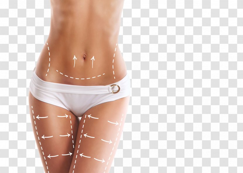 Plastic Surgery Surgeon Body Contouring Abdominoplasty - Heart - In Addition To Cellulite Transparent PNG