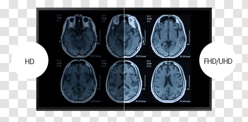 Functional Magnetic Resonance Imaging Computed Tomography Traumatic Brain Injury - Silhouette - Medical Supplies. Transparent PNG