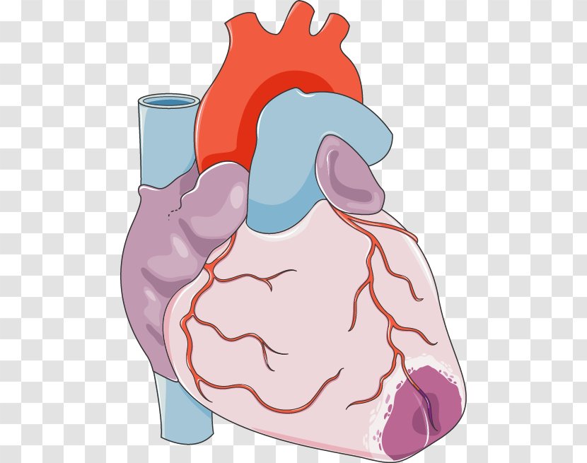 Heart Acute Myocardial Infarction Coronary Artery Bypass Surgery Cardiovascular Disease - Watercolor Transparent PNG