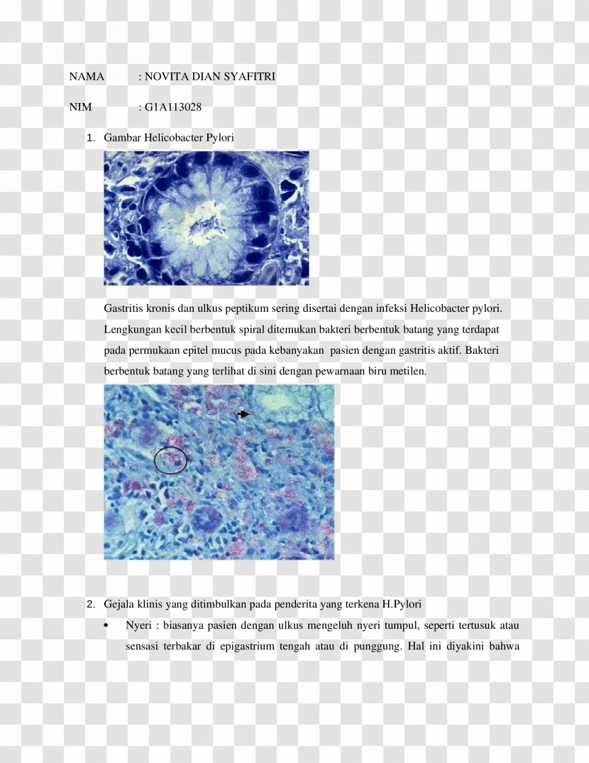 Helicobacter Pylori Giemsa Stain Organism Brochure Transparent PNG