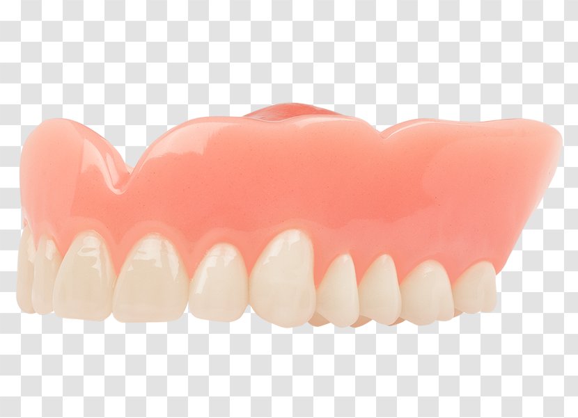 Dentures Tooth Dentistry Aspen Dental Implant - Lip - Crown Transparent PNG