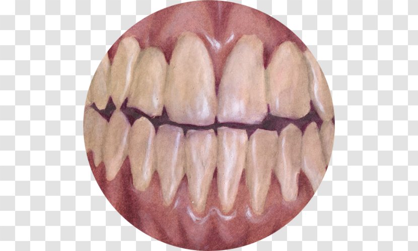 Human Tooth Homo Sapiens Sycra Clip Art - Crooked Transparent PNG