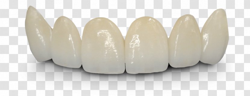Bridge Crown Dentistry Dentures Tooth - Zirconium Dioxide Transparent PNG