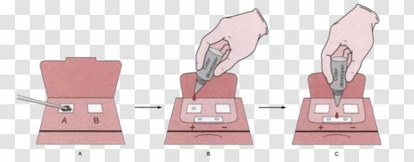 Fecal Occult Blood Stool Guaiac Test - Tree Transparent PNG