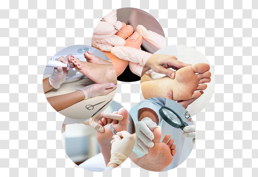 Plasencia Podiatry Podiatrist Foot Therapy - Nail - Health Transparent PNG
