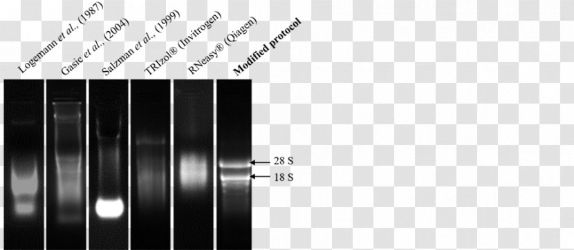 RNA Extraction Phenol–chloroform Trizol DNA - Rna - Mulberry Tree Leaves Identification Transparent PNG