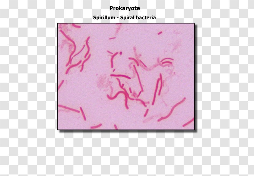Staining Spirillum Gram-negative Bacteria Gram Stain Gram-positive - Magenta - Micro Transparent PNG