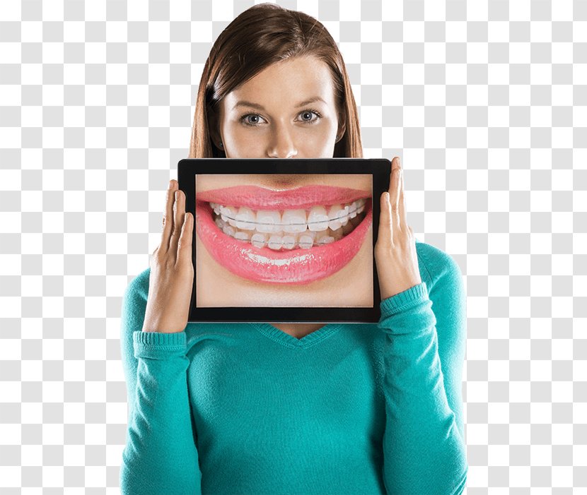 Cosmetic Dentistry Orthodontics Dental Braces - Dentist Transparent PNG