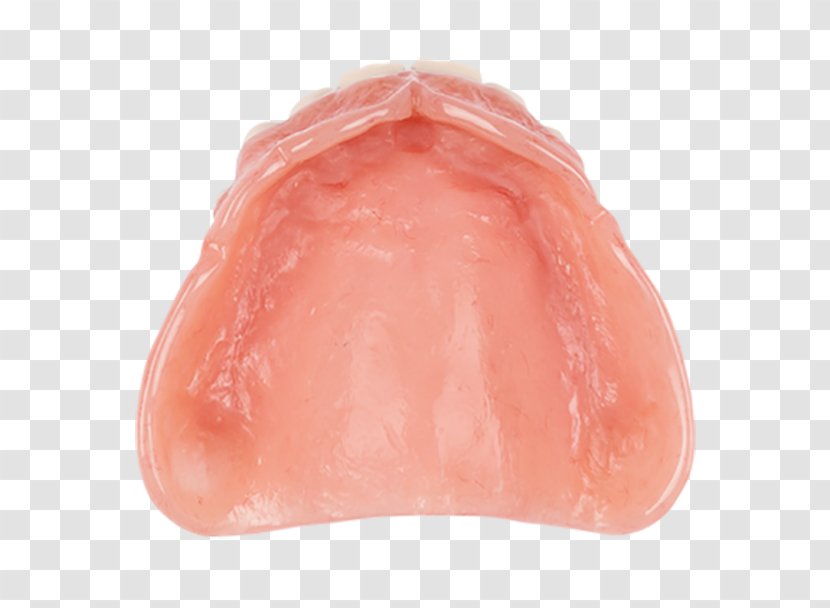 Dentures Dentistry Aspen Dental Lip The Heat - Frame Transparent PNG
