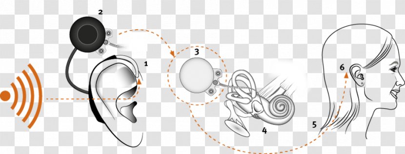 Cochlear Implant Sound - Tree - Ear Transparent PNG