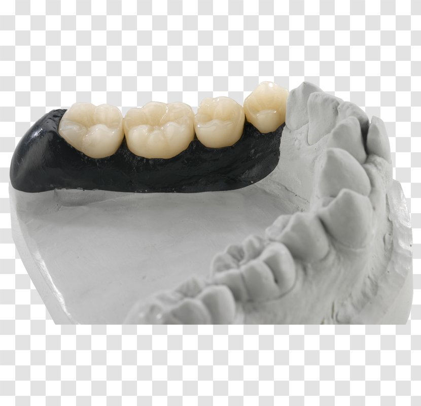 Dentist Dental Technician Laboratory Anatomická Pinzeta Zahntechnik - Tooth - Multilayer Transparent PNG