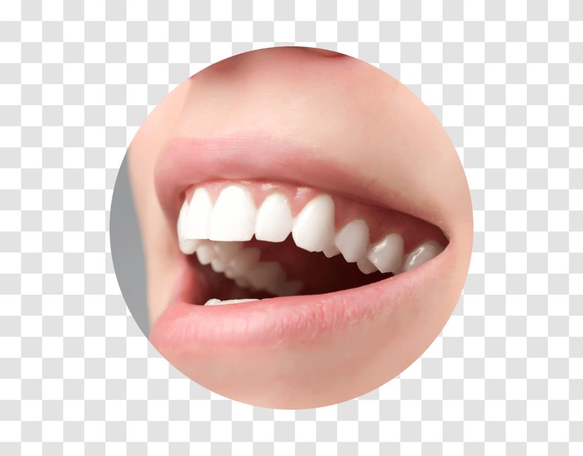 Crown Ceramic Tooth Veneer Dentistry - Smile Transparent PNG