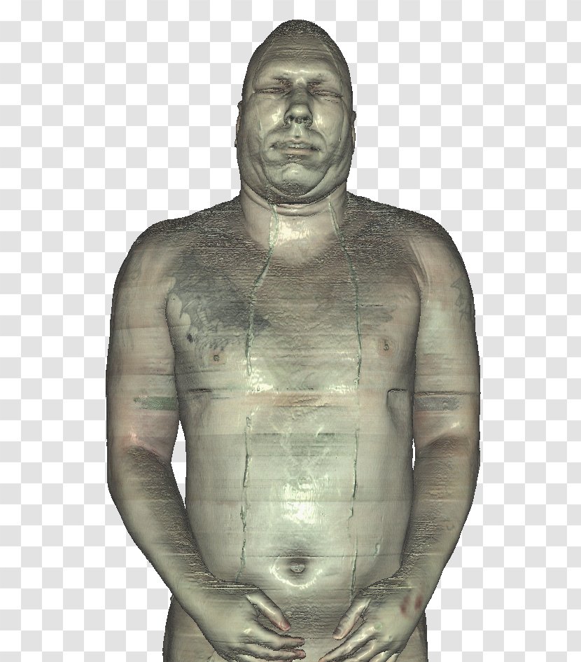 Joseph Paul Jernigan Visible Human Project Homo Sapiens Anatomy Body - Heart - Ice Block Transparent PNG