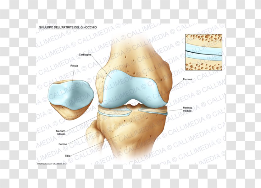 Knee Osteoarthritis Anatomy Bone Fracture - Frame - Ear Transparent PNG