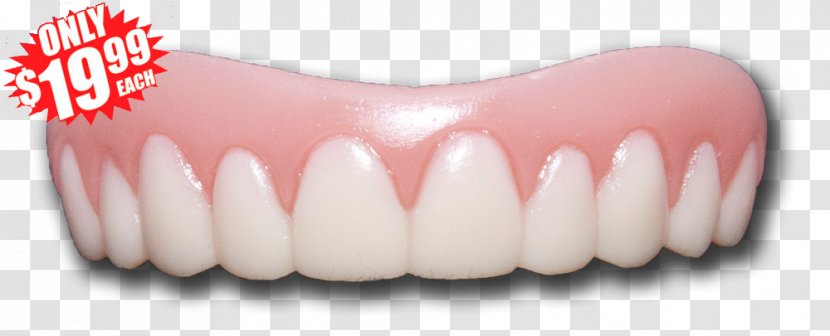 Human Tooth Smile Veneer Cosmetic Dentistry - Pathology Transparent PNG