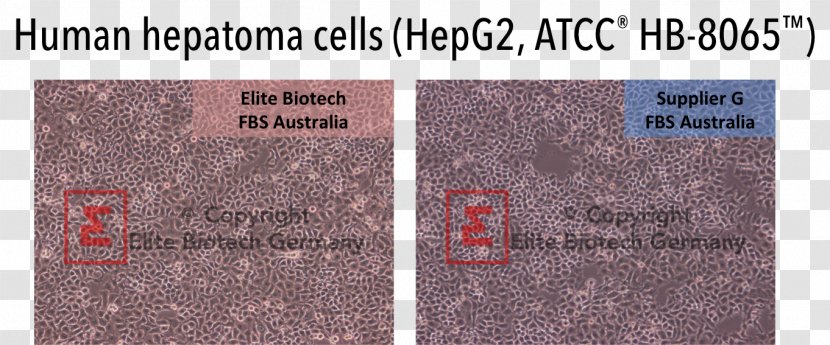 Hep G2 Cell Culture ATCC Biotechnology - Text Transparent PNG