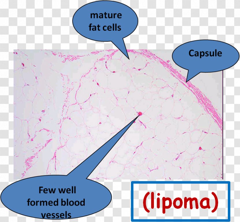 Neoplasm Tissue Water - Ak 47 Transparent PNG