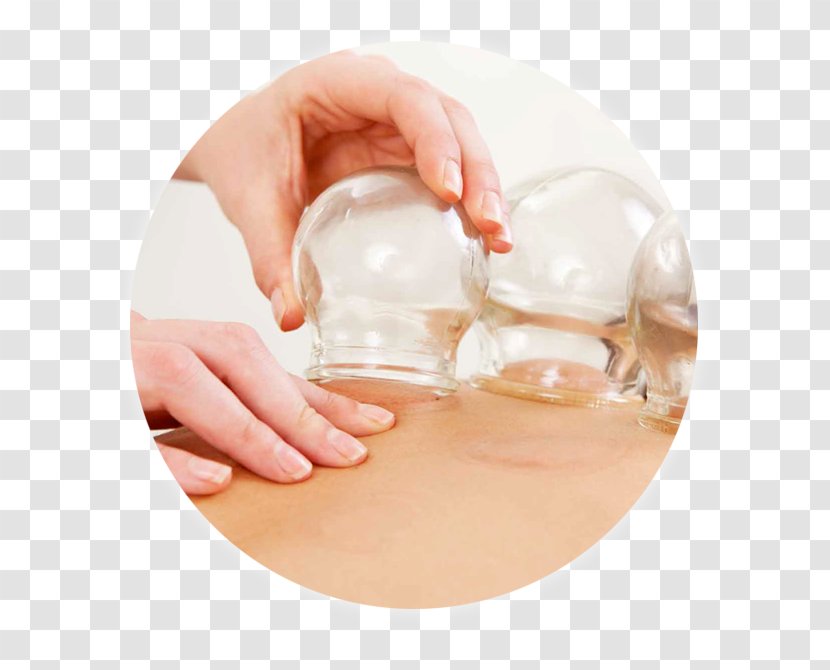 Cupping Therapy Bekam Medicine Massage Transparent PNG