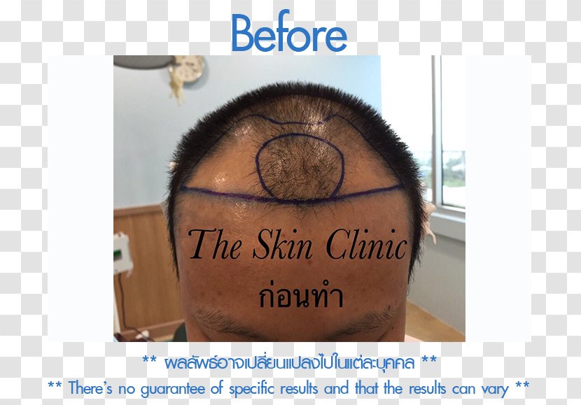 Brand Font - Skin Clinic Transparent PNG
