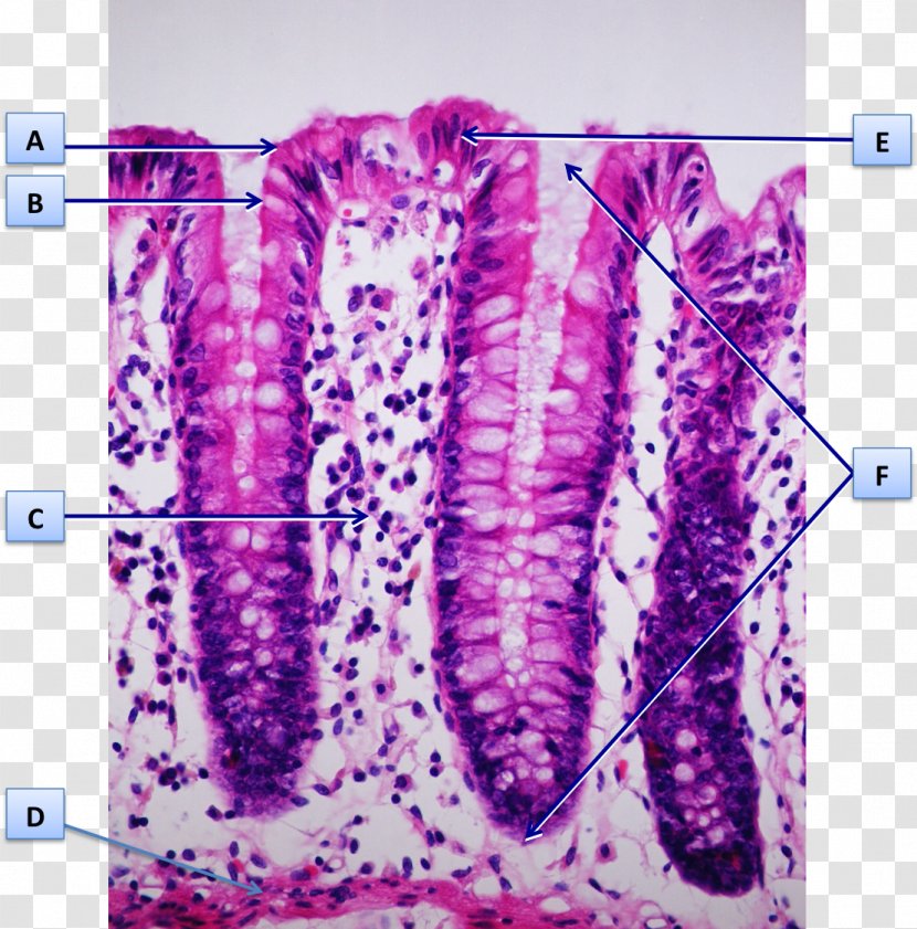 Mucous Membrane Intestinal Gland Goblet Cell Histology Colon - He Stain - LETRA F Transparent PNG