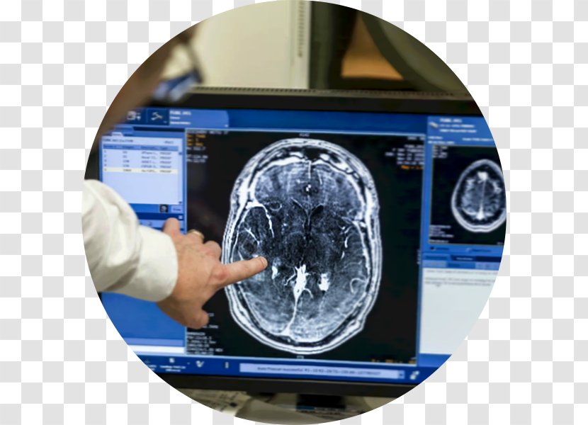 Blood–brain Barrier Scientist Cancer Surgery - Medical Equipment - Brain Transparent PNG