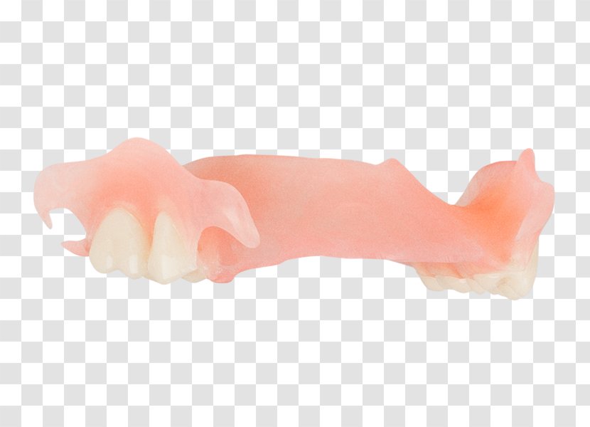 Dentures Dentistry Jaw 総義歯 Tooth - Art - Aspen Dental Transparent PNG