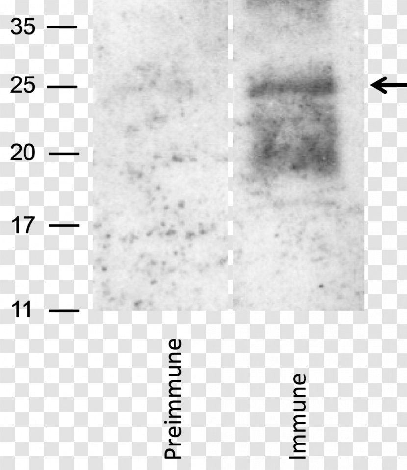 Reverse Transcriptase RNA Sf9 Cell Virus - Atmosphere - Sterilized Antibody Transparent PNG