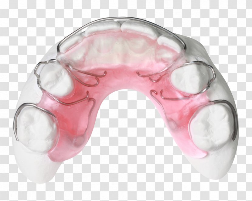 Gergen's Orthodontic Lab Technology Gergens Orthodontics Bionator Transparent PNG
