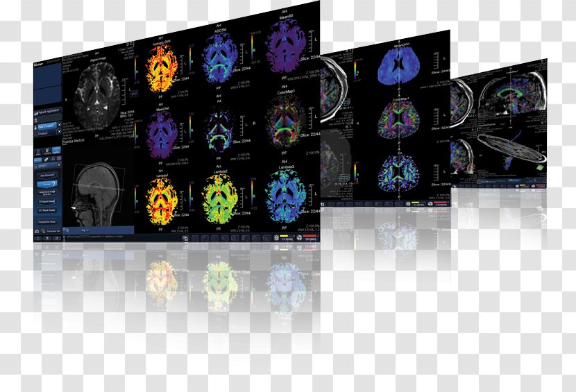 Magnetic Resonance Imaging Toshiba Canon Medical Systems Corporation MRI-scanner - Mriscanner - Technology Transparent PNG