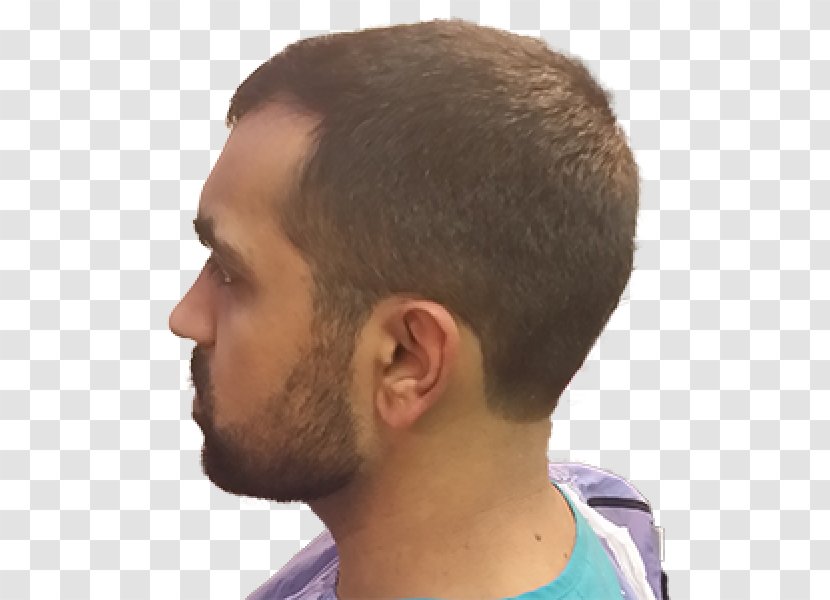 Buzz Cut Facial Hair Chin Jaw Forehead - Nose Transparent PNG