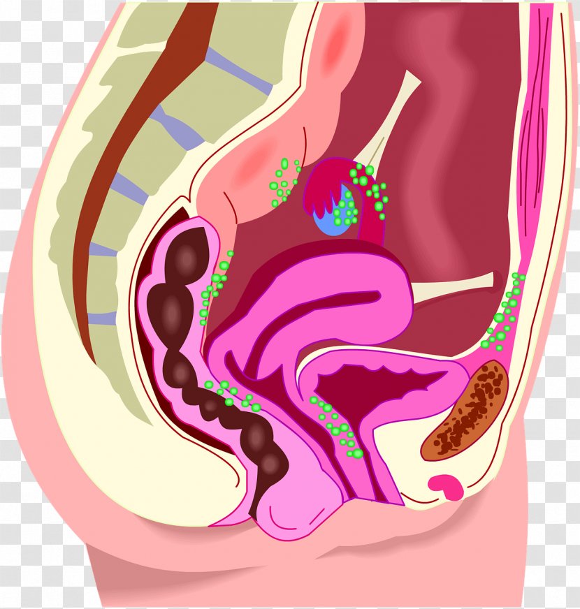 Menstruation Endometriosis Uterus Endometrium Disease - Silhouette - The Delicacy Transparent PNG