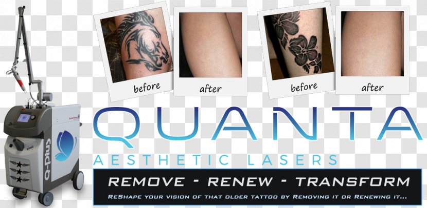 Flashpoint Tattoo Company Removal Laser Cover-up - 2017 - Therapy Transparent PNG
