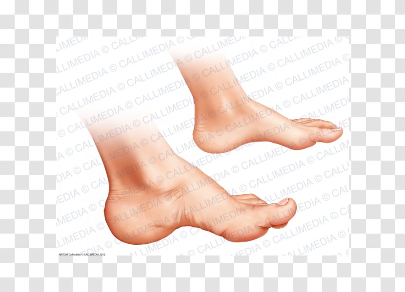 Toe Ankle Foot Podiatry Acromegaly - Cartoon - Acromegalia Transparent PNG