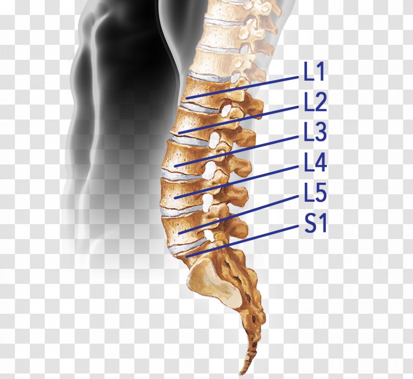 Vertebral Column Spinal Disc Herniation Intervertebral Lumbar Vertebrae Cord - Organism - Sacrum Bone Pain Transparent PNG