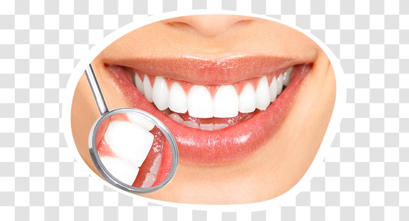 Tooth Whitening Cosmetic Dentistry Human - Mouth - Smile Transparent PNG