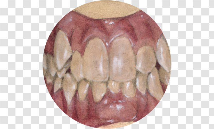 Close-up - Tooth - Crooked Transparent PNG