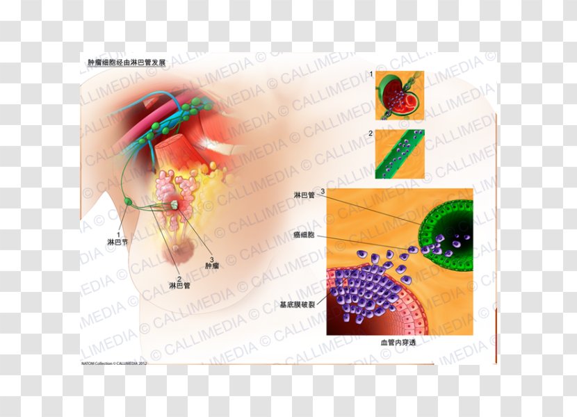 Graphic Design Sentinel Lymph Node Transparent PNG