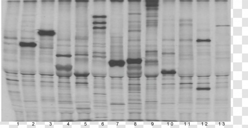 Autoantibody Polymyositis Antiphospholipid Syndrome Pattern - Black And White - Material Transparent PNG