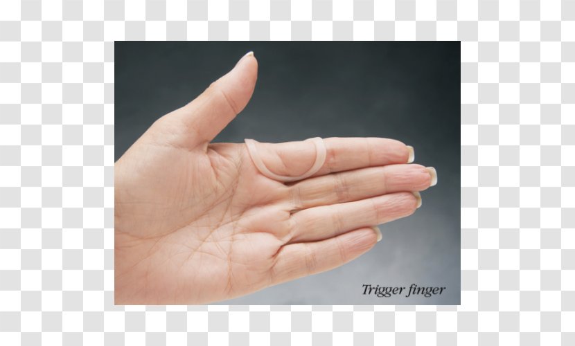 Splint Mallet Finger Boutonniere Deformity Swan Neck - Tree - Trigger Thumb Transparent PNG