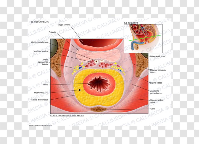 Total Mesorectal Excision Femur Anatomy Human Skeleton Hypogastric Nerve - Frame - Digestive System Of Transparent PNG