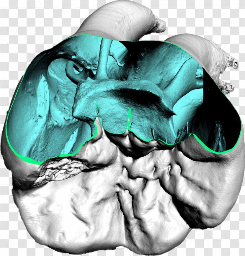 Dentistry Computed Tomography Dental Impression - Silhouette - X-ray Transparent PNG