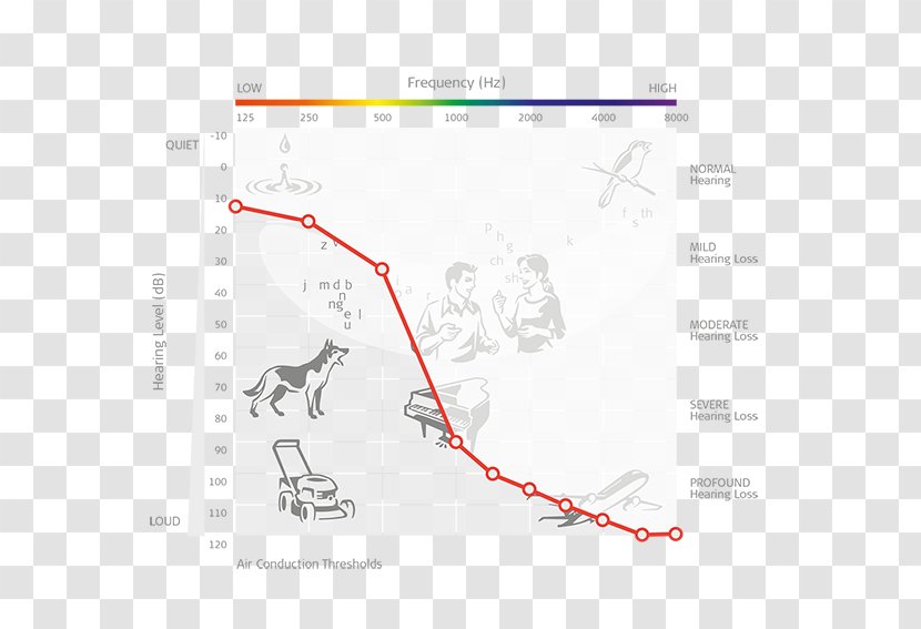 Audiogram Cochlear Implant Audiometry Hearing Loss MED-EL - Acoustic Stimulation Transparent PNG