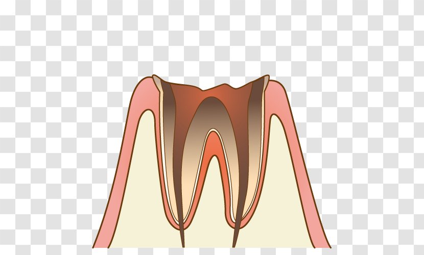 歯科 Dentist Periodontal Disease Tooth Decay - Silhouette - Cavity Transparent PNG