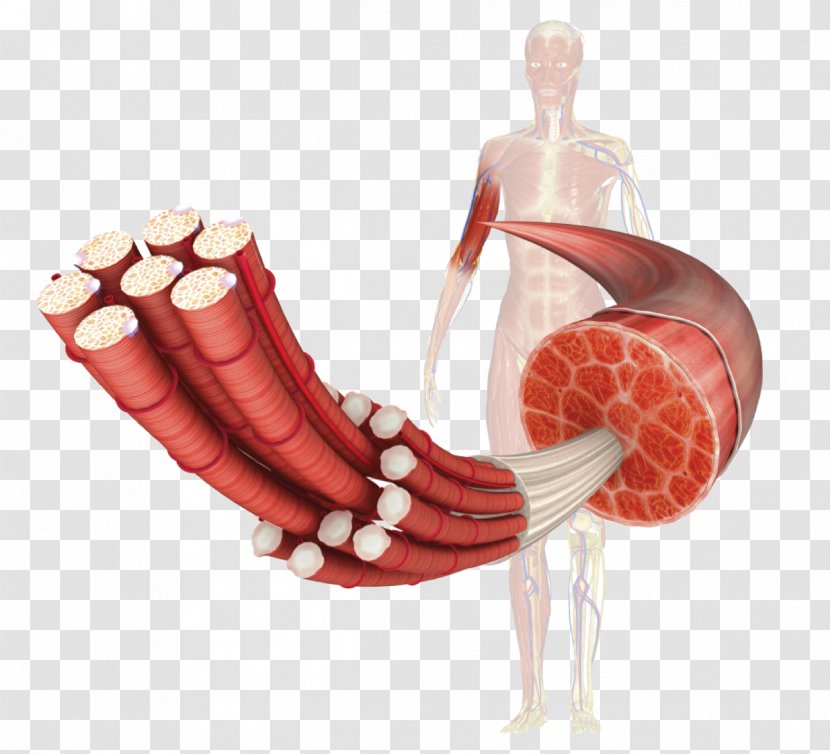 Muscular Dystrophy Duchenne Distrophy Skeletal Muscle Dystrophin - Cartoon - Silhouette Transparent PNG