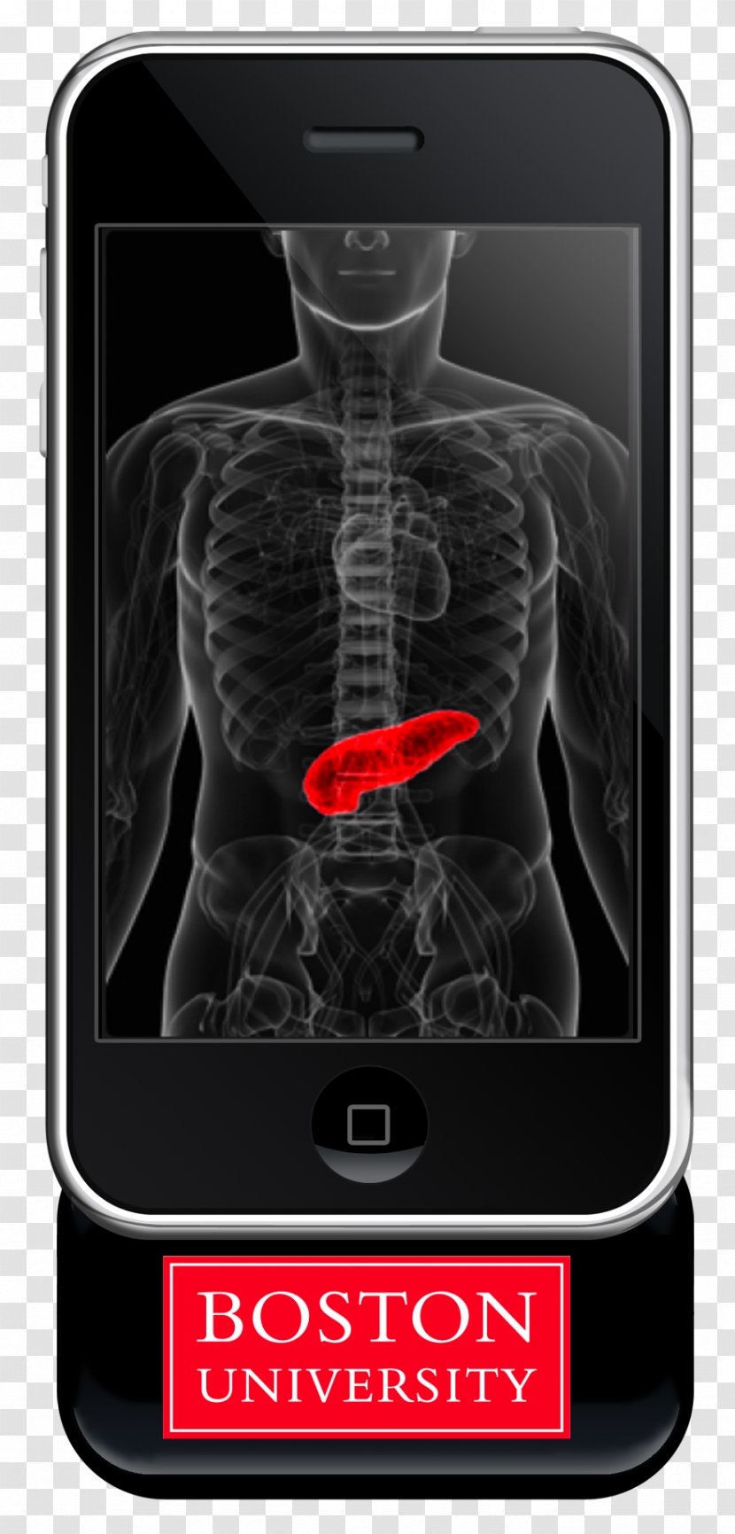 Diabetes Mellitus Kidney Failure Pancreas Insulin - Health Transparent PNG