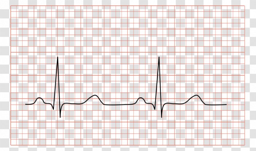 Electrocardiography Electrocardiogram Cardiology Heart Medicine Transparent PNG