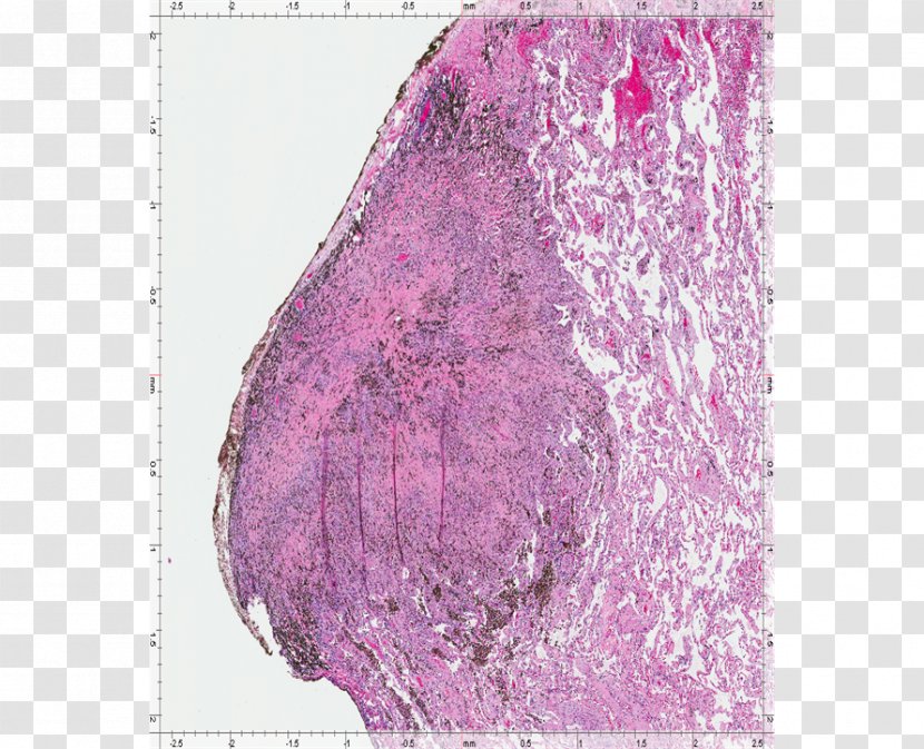 Silk Pink M - Purple - Pleural Cavity Transparent PNG