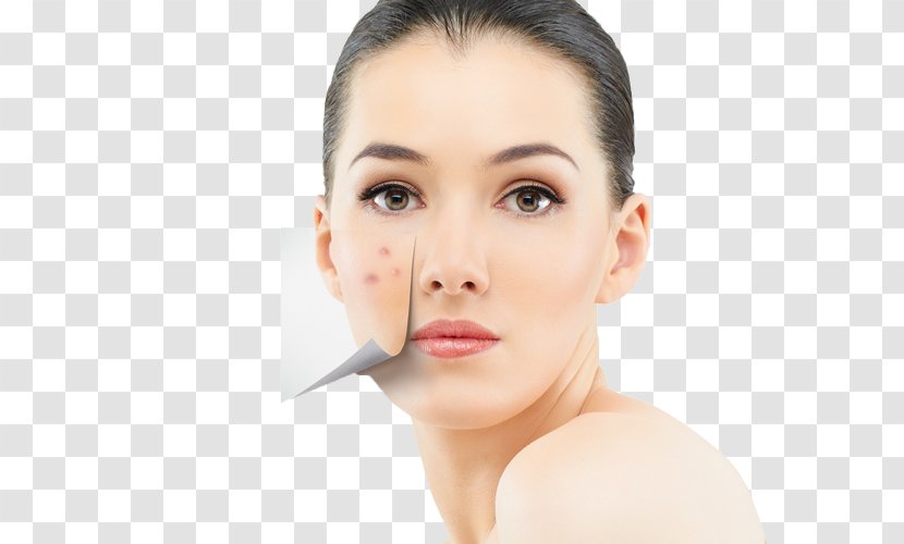 Skin Care Health Acne Diet Transparent PNG